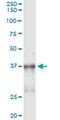 NK2 Homeobox 5 antibody, MA5-18671, Invitrogen Antibodies, Immunoprecipitation image 