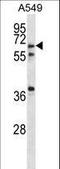 Glucagon Like Peptide 2 Receptor antibody, LS-C166510, Lifespan Biosciences, Western Blot image 