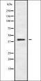 Hemoglobin Subunit Theta 1 antibody, orb336349, Biorbyt, Western Blot image 