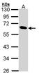 Pancreatic Lipase antibody, LS-C186113, Lifespan Biosciences, Western Blot image 