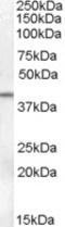 Serpin Family B Member 6 antibody, EB08577, Everest Biotech, Western Blot image 