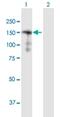 Sorbin And SH3 Domain Containing 2 antibody, H00008470-B01P, Novus Biologicals, Western Blot image 
