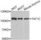TATA-Box Binding Protein Associated Factor, RNA Polymerase I Subunit C antibody, abx005183, Abbexa, Western Blot image 