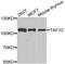 RNA polymerase I-specific TBP-associated factor 110 kDa antibody, abx005183, Abbexa, Western Blot image 