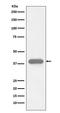 Troponin T2, Cardiac Type antibody, M01154, Boster Biological Technology, Western Blot image 