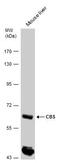 Cystathionine-Beta-Synthase antibody, PA5-22273, Invitrogen Antibodies, Western Blot image 