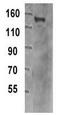 Tripartite Motif Containing 33 antibody, GTX15826, GeneTex, Western Blot image 