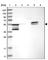 Epoxide Hydrolase 2 antibody, HPA023094, Atlas Antibodies, Western Blot image 