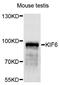 Kinesin Family Member 6 antibody, STJ29751, St John