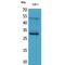 Fibroblast Growth Factor 23 antibody, LS-C386931, Lifespan Biosciences, Western Blot image 