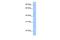 LIPT1 antibody, GTX46191, GeneTex, Western Blot image 