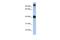 Transcription Factor AP-2 Epsilon antibody, A12881, Boster Biological Technology, Western Blot image 