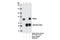 Neurofibromin 2 antibody, 12888S, Cell Signaling Technology, Immunoprecipitation image 