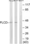 1-Acylglycerol-3-Phosphate O-Acyltransferase 4 antibody, LS-C119602, Lifespan Biosciences, Western Blot image 