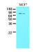 Tyrosyl-DNA Phosphodiesterase 1 antibody, AM09086PU-N, Origene, Western Blot image 