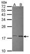 UBE2L3 antibody, NBP2-20786, Novus Biologicals, Western Blot image 