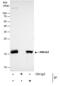 High Mobility Group AT-Hook 2 antibody, PA5-21320, Invitrogen Antibodies, Immunoprecipitation image 