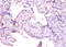 Matrix Metallopeptidase 1 antibody, A54041-100, Epigentek, Immunohistochemistry paraffin image 