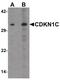 Cyclin Dependent Kinase Inhibitor 1C antibody, PA5-34432, Invitrogen Antibodies, Western Blot image 