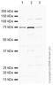 Protein Arginine Methyltransferase 5 antibody, ab31751, Abcam, Western Blot image 