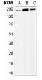 Lysine Acetyltransferase 6B antibody, GTX56004, GeneTex, Western Blot image 