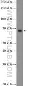 HIC ZBTB Transcriptional Repressor 2 antibody, 22788-1-AP, Proteintech Group, Western Blot image 