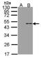 Arylsulfatase B antibody, PA5-27794, Invitrogen Antibodies, Western Blot image 