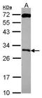 Kallikrein Related Peptidase 10 antibody, NBP2-19971, Novus Biologicals, Western Blot image 