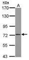Cleavage And Polyadenylation Specific Factor 3 antibody, PA5-30631, Invitrogen Antibodies, Western Blot image 
