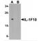 Interleukin 1 Family Member 10 antibody, MBS153432, MyBioSource, Western Blot image 