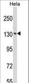 CAP-Gly Domain Containing Linker Protein 1 antibody, LS-C168841, Lifespan Biosciences, Western Blot image 