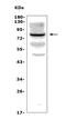 Choline O-Acetyltransferase antibody, A01192-5, Boster Biological Technology, Western Blot image 