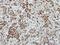H2A Histone Family Member Y2 antibody, GTX116234, GeneTex, Immunohistochemistry paraffin image 