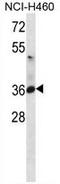 ATPase Na+/K+ Transporting Subunit Beta 3 antibody, AP50295PU-N, Origene, Western Blot image 