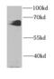 HCK Proto-Oncogene, Src Family Tyrosine Kinase antibody, FNab03785, FineTest, Western Blot image 