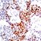 Janus Kinase 2 antibody, orb14527, Biorbyt, Immunohistochemistry paraffin image 