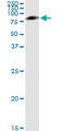 C1 esterase inhibitor antibody, LS-B6012, Lifespan Biosciences, Immunoprecipitation image 