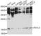 Achaete-Scute Family BHLH Transcription Factor 4 antibody, A14865, Boster Biological Technology, Western Blot image 