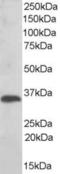 Thioredoxin-related transmembrane protein 1 antibody, LS-B4919, Lifespan Biosciences, Western Blot image 