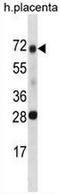 Serine Peptidase Inhibitor, Kunitz Type 1 antibody, AP54023PU-N, Origene, Western Blot image 