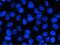 B-cell CLL/lymphoma 9-like protein antibody, A05905, Boster Biological Technology, Immunofluorescence image 