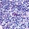 Cytochrome P450 Family 19 Subfamily A Member 1 antibody, PA1-21398, Invitrogen Antibodies, Immunohistochemistry frozen image 