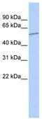 Solute Carrier Family 39 Member 7 antibody, TA334120, Origene, Western Blot image 