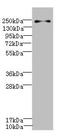 Secretory phospholipase A2 receptor antibody, LS-C676271, Lifespan Biosciences, Western Blot image 