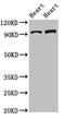 Glycerol-3-Phosphate Acyltransferase, Mitochondrial antibody, LS-C678116, Lifespan Biosciences, Western Blot image 