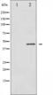 Ribosomal Protein S6 Kinase B2 antibody, abx012031, Abbexa, Western Blot image 