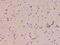 MAGE Family Member B10 antibody, 205166-T08, Sino Biological, Immunohistochemistry paraffin image 