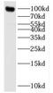 Synuclein Alpha Interacting Protein antibody, FNab08061, FineTest, Western Blot image 