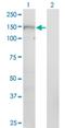 Patatin Like Phospholipase Domain Containing 6 antibody, H00010908-M08, Novus Biologicals, Western Blot image 