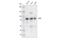 Lysine Demethylase 1B antibody, 54576S, Cell Signaling Technology, Western Blot image 